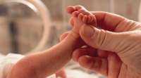 Afinal, o que acontece com um bebê que nasce com microcefalia? Entenda