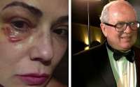 Ex de Luiza Brunet diz ter sofrido várias agressões da atriz