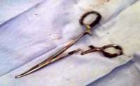 Homem é operado para retirar tesoura esquecida em cirurgia há 18 anos