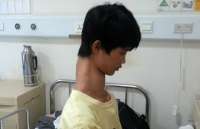Garoto com pescoço &#039;gigante&#039; vai ser operado na China