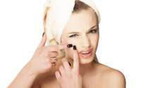 Anote 7 valiosas dicas para se livrar da acne sem sofrimento