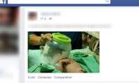 Hospital improvisa pote de plástico para salvar vida de bebê