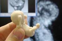 Impressão 3D traz o bebê do ultrassom à realidade