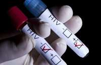 Segundo estudo, no mundo há 2,5 milhões de novos casos de HIV por ano
