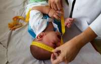 Projeto de lei prevê aumento de pena para aborto em caso de microcefalia