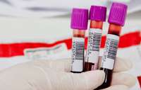 Fim do jejum de 12 horas para exame de colesterol é autorizado no Brasil