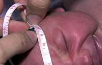 Médicos investigam lesões oculares em recém-nascidos por causa da zika