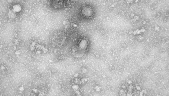 Ministério da Saúde e Sesa confirmam caso suspeito do novo coronavírus no Paraná