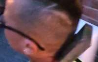 Menino autista fica com pedaço de madeira pregado na cabeça em caso de bullying