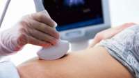 Exame permite rastrear síndromes já no 1º trimestre da gravidez