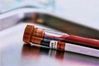 Exame de sangue pode indicar propensão ao suicídio