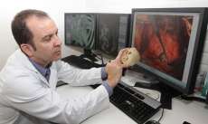Paraná &quot;cria&quot; biomodelo de coração feito em 3D