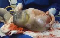 Bebê nasce dentro de saco amniótico em parto raro. Veja o vídeo!