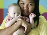 Bebê abandonado vai para hospital especializado em síndrome de Down