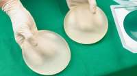 Alternativas à prótese de silicone podem causar danos irreparáveis ao corpo