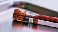 Novo exame de sangue pode detectar problemas cardíacos desconhecidos