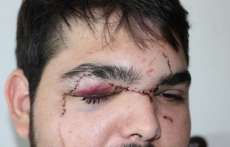 &quot;Calouro não precisa ser humilhado só porque é calouro&quot;, diz jovem agredido por recusar trote