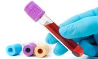 Pesquisa global inédita busca ampliar a qualidade de vida de pessoas com hemofilia