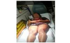 Palmital - Mulher fica ferida no tórax