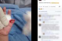 Enfermeira corta dedo de bebê em hospital