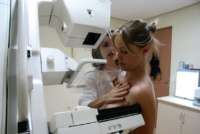 Aprovado projeto de obrigatoriedade de mamografia gratuita para mulheres a partir de 40 anos