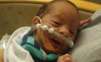 Este bebê nasceu no carro, prematuro e em um fenômeno bem raro