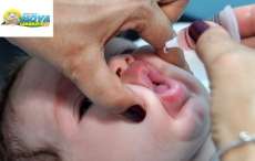 Nova Laranjeiras - Campanha de vacinação contra a Poliomelite começa em novembro. Veja o cronograma