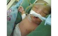 Bebê com doença grave depende de cirurgia de R$ 2 milhões para sobreviver