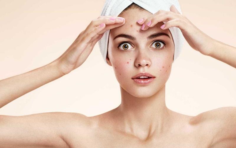Estratégias mais certeiras para tratar a acne em adulto