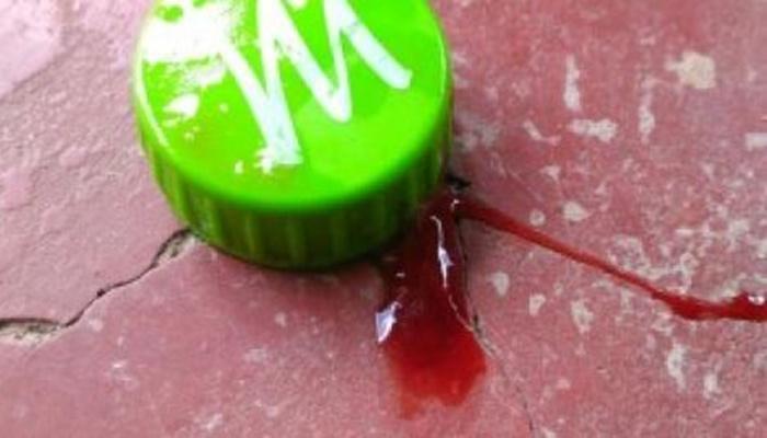 Criança de 3 anos é socorrida com tampa de garrafa pet presa na garganta
