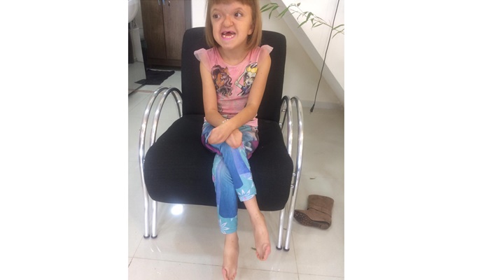 Laranjeiras - Criança laranjeirense com síndrome rara precisa de cirurgia