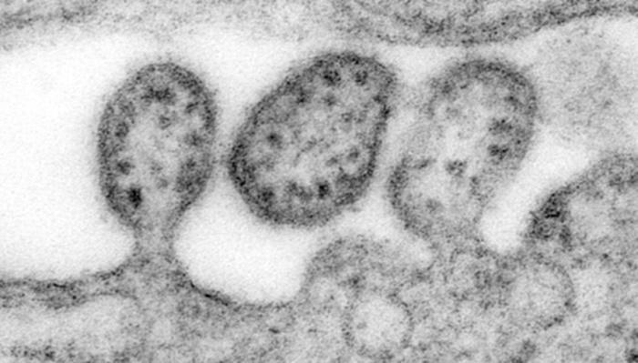 Ministério da Saúde confirma morte por vírus não registrado há 20 anos no País
