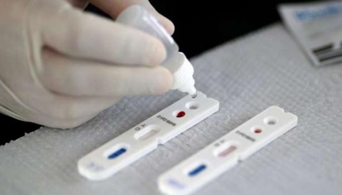 Butantan busca desenvolver vacina alternativa contra covid-19