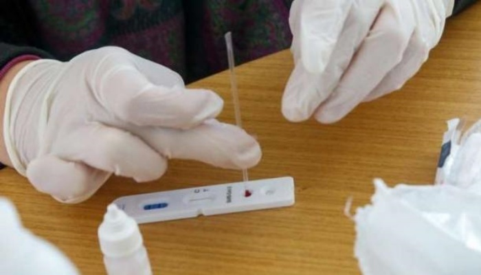 Paraná distribui mais 178 mil testes rápidos aos municípios