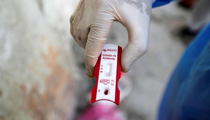 Covid-19: Brasil chega a 47,7 mil mortes e 978,1 mil casos confirmados