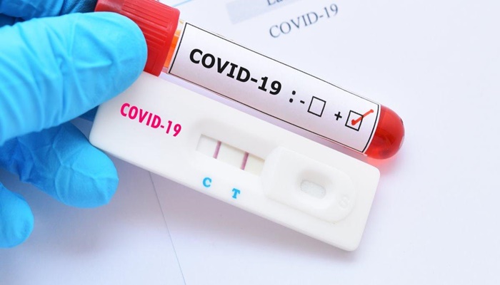 Quedas - Criança de 11 meses é diagnosticada com Covid -19 
