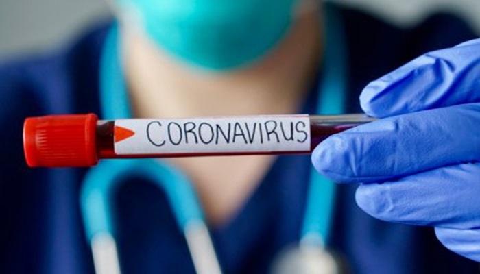 Nova Laranjeiras - Saúde em alerta : Mais 05 casos de Covid- 19 são confirmados no município 