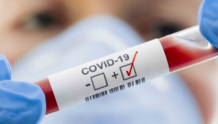 Nova Laranjeiras - Saúde em Alerta - Mais 06 casos de Covid - 19 foram registrados nas últimas horas