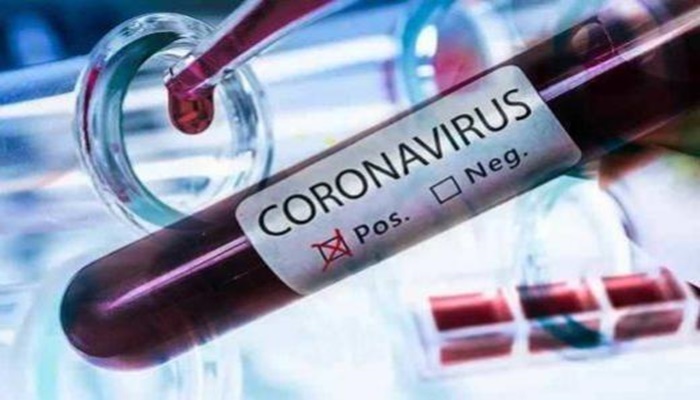 Porto Barreiro - Município confirma 3 novos casos de coronavírus