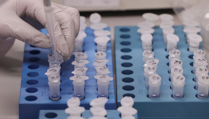 Reinfecções pelo novo coronavírus criam dúvidas sobre imunidade