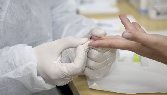 OMS: testes populacionais amplos de covid-19 nem sempre são úteis