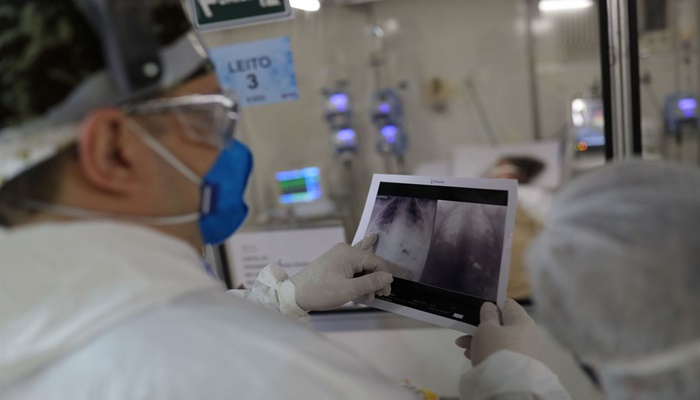 Fiocruz: síndrome respiratória grave tende a aumentar em oito estados