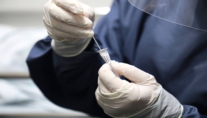 Estado distribui testes rápidos e oxímetros para municípios das 22 Regionais de Saúde