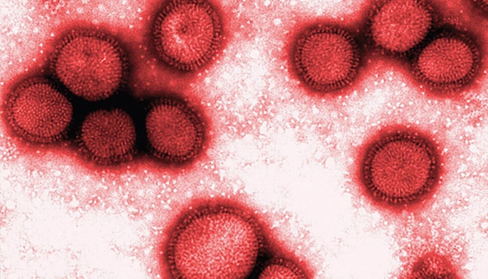 Laranjeiras – Município registra 1º caso de gripe do subtipo H3N2