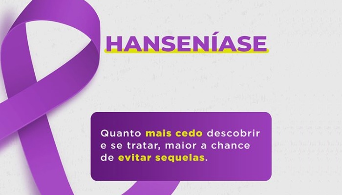 Laranjeiras - Campanha Janeiro Roxo reforça o combate a Hanseníase 
