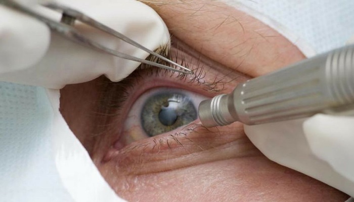 Doença ocular relacionada à idade pode levar à cegueira