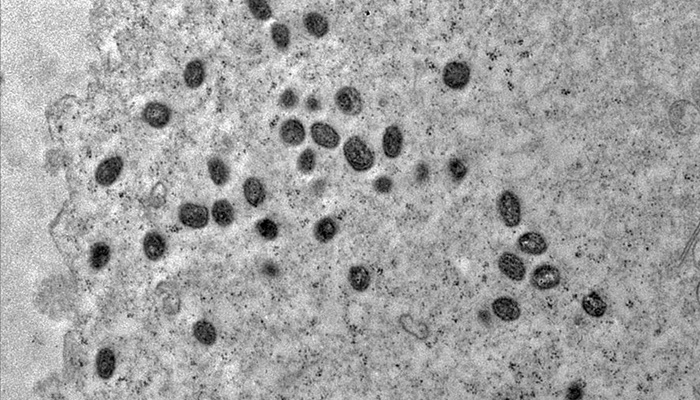 Mpox ainda é problema de saúde pública, dizem especialistas da Fiocruz