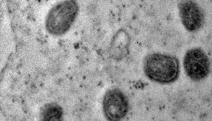 OMS declara fim da emergência em saúde por mpox