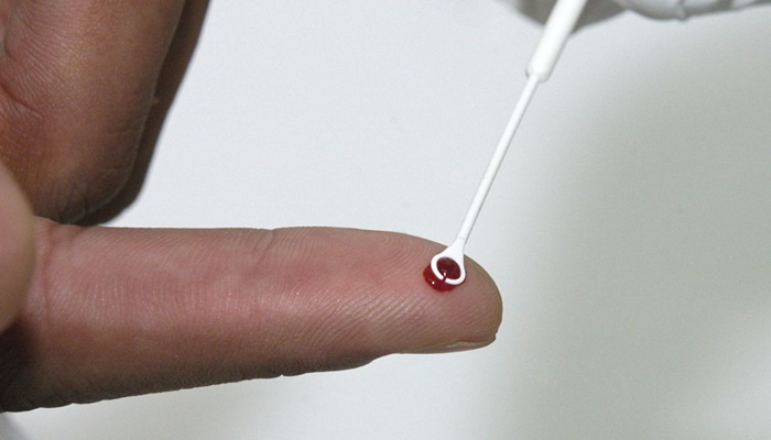 Medicamento injetável é nova opção de prevenção contra HIV no Brasil 