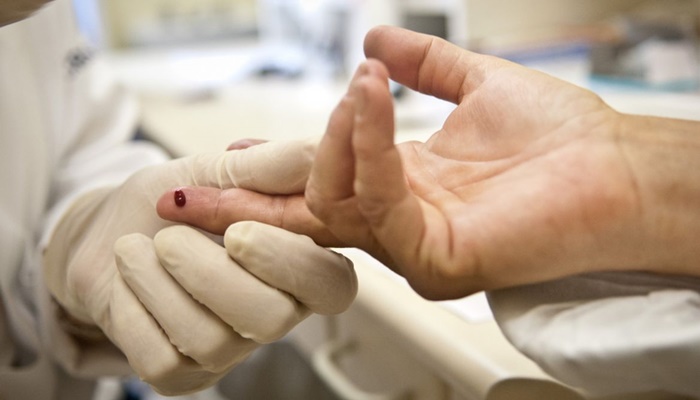 Pandemia de Aids pode acabar até 2030, diz Unaids